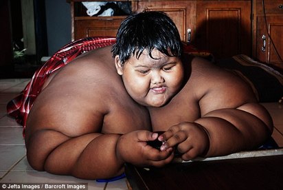 世界最胖男孩 190公斤被警告會”吃到胖死” | 