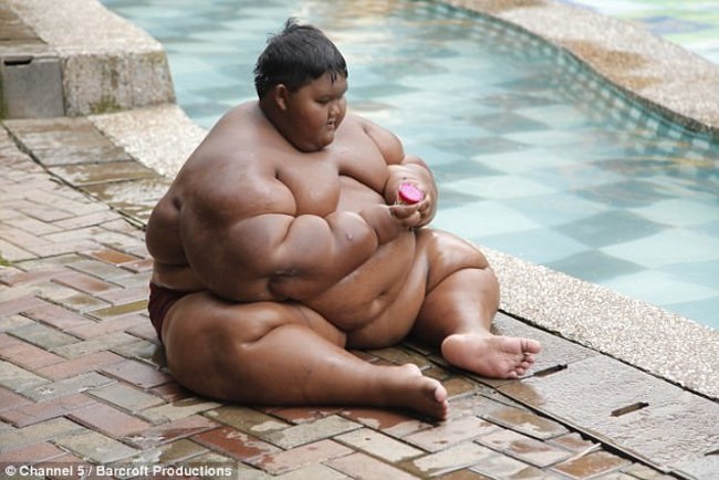 世界最胖男孩 190公斤被警告會”吃到胖死” | 華視新聞