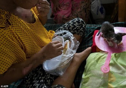 緬甸13歲女童工遭雇主拿熨斗燙 滿身傷送醫治療 | 女童工被雇主拿熨斗燙傷。