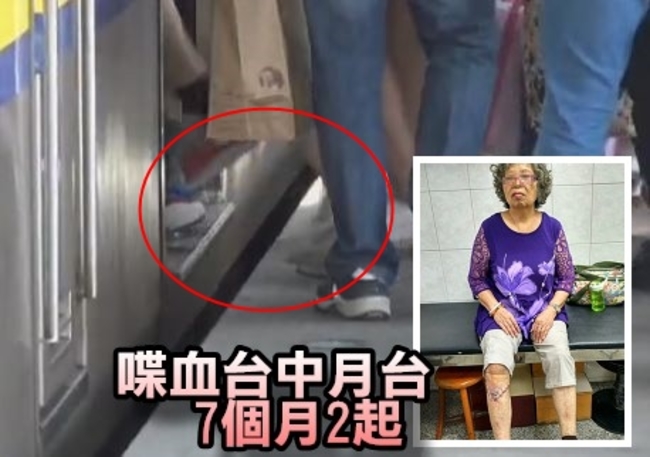 台中車站藏「砍斷腿月台」 嬤踩空腿掀開縫40針 | 華視新聞