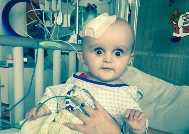 不是可愛是驚悚! 大眼寶寶竟患腦瘤 | 華視新聞
