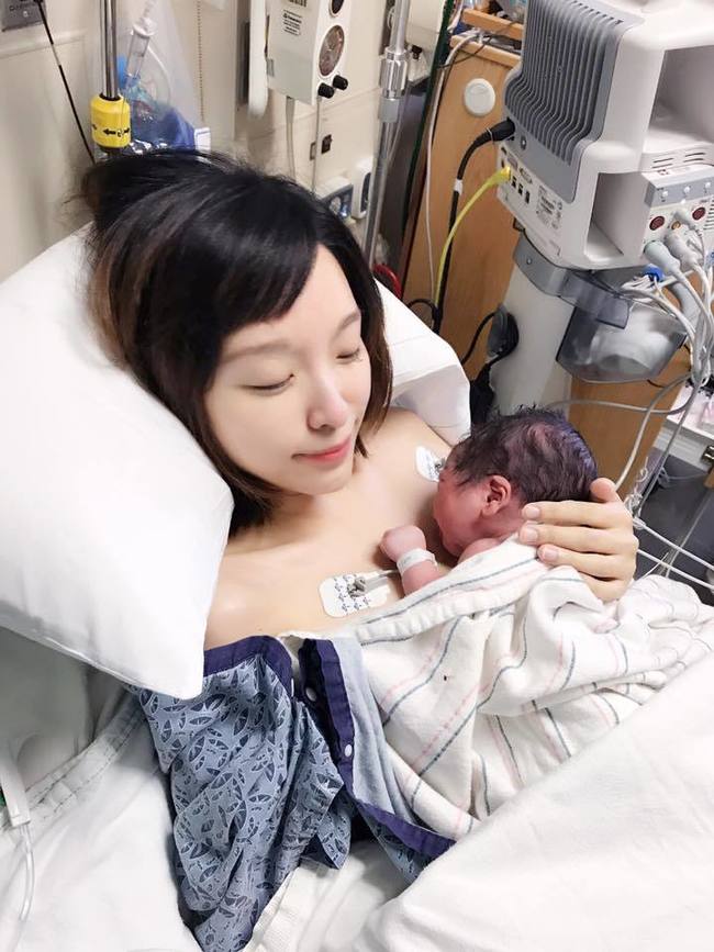 張宇剖腹產 健康寶寶出生夫妻哭成一團 | 華視新聞