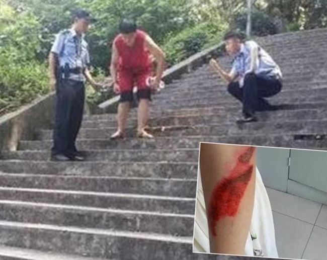 超可惡! 男子樓梯推女摔落 全因為”想聽女生尖叫” | 華視新聞