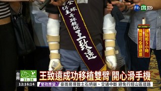 異體雙臂移植 王致遠台灣首例!