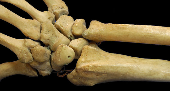 英科學家培育出"人類骨骼" 自體細胞移植不易排斥 | 華視新聞