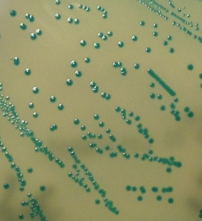 李斯特菌症將列法定傳染病 食物方面要注意 | 李斯特菌選擇性呈色培養基生長的菌落(疾管署提供)