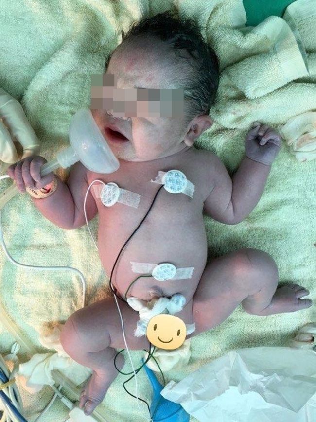 先天心臟病女嬰 緊抓氧氣罩"要爸媽別擔心" | 華視新聞