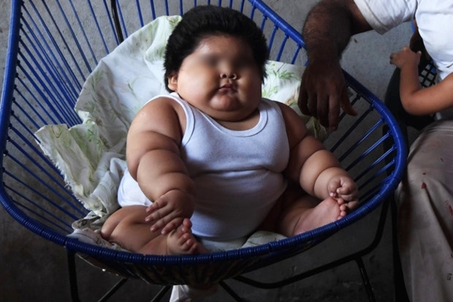10個月28公斤 巨嬰媽以為是"母乳太營養" | 華視新聞