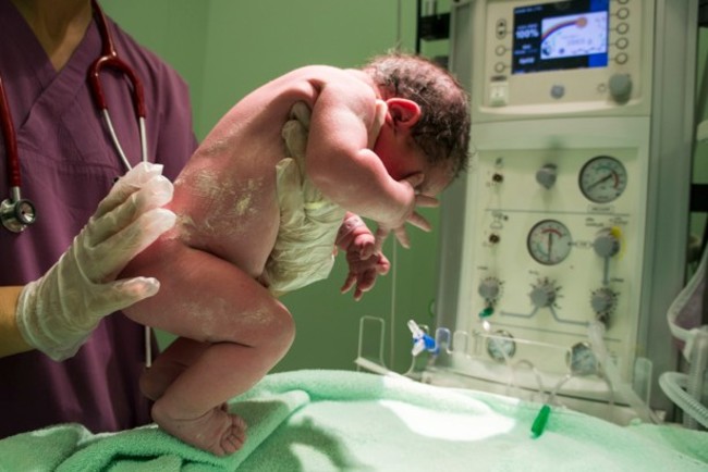 不孕者移植子宮 美國首例成功懷胎產子 | 華視新聞
