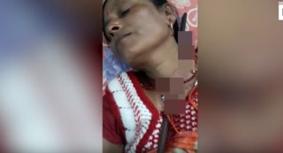 印度女遭鋼筋刺穿頸 醫生驚嘆"還好沒先拔出來"