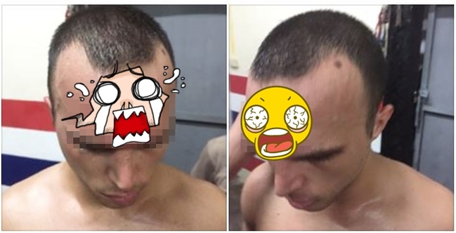 【影】慎入! 泰拳選手遭肘擊 額頭竟變這樣 | 華視新聞