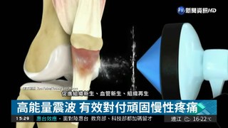 治療慢性肌腱炎 震波能量效果佳