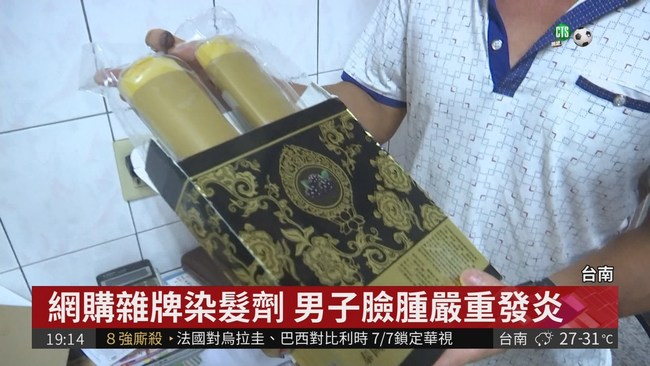 網購雜牌染髮劑 男子臉腫嚴重發炎 | 華視新聞