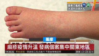 麻疹疫情大爆發! 日本連7週患者破百