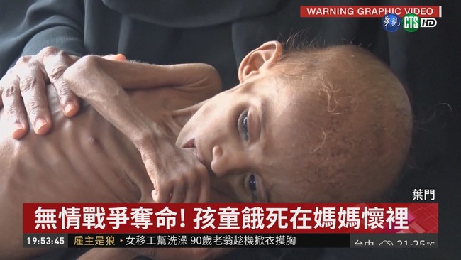 葉門內戰鬧飢荒! 8.5萬兒童被餓死 | 華視新聞