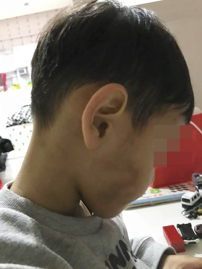 又傳虐童！ 3歲童遭不合格老師捏臉 滿臉瘀青 | 華視新聞