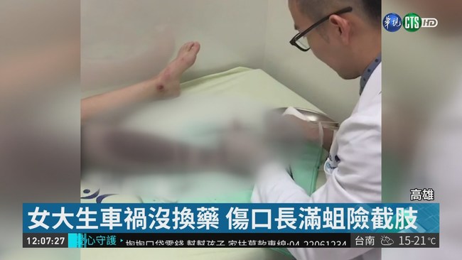 女大生車禍沒換藥 傷口長滿蛆險截肢 | 華視新聞
