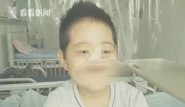 男童細菌感染半張臉遭噬 雙親藏起家中所有鏡子 | 華視新聞