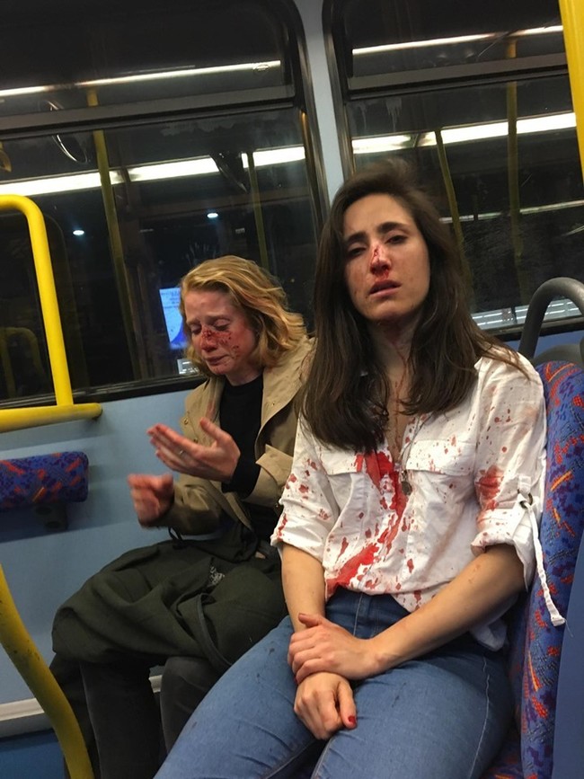 英國女同志遭毆濺血 「仍會勇敢堅持性向」 | 華視新聞