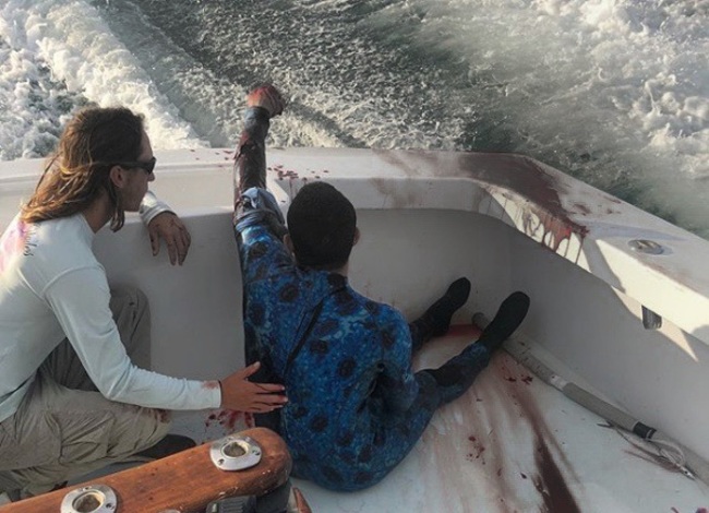 邁阿密驚傳鯊魚咬人 潛水男遭襲滿身血 | 華視新聞