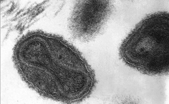 存放天花、伊波拉病毒 俄實驗室驚傳爆炸 | 華視新聞