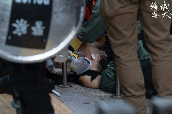 反送中》國殤大遊行 示威者左胸中彈...警證實開槍 | 華視新聞