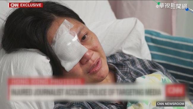 遭港警射擊右眼失明 印尼記者討公道 | 華視新聞