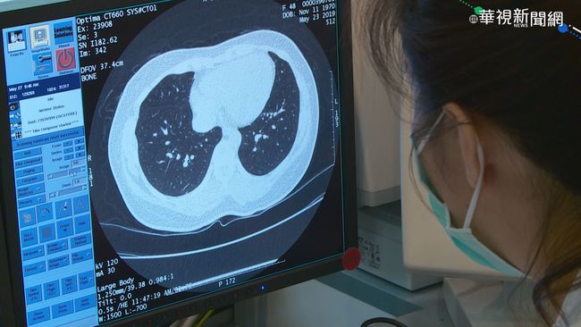 空汙是原凶? 台灣肺癌發生率亞洲第2 | 華視新聞