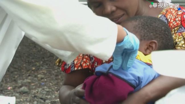 半年奪6千條命! 剛果麻疹疫情蔓延 | 華視新聞