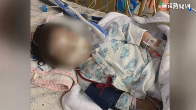流感來勢洶洶 台南1歲女童併發腦炎 | 華視新聞