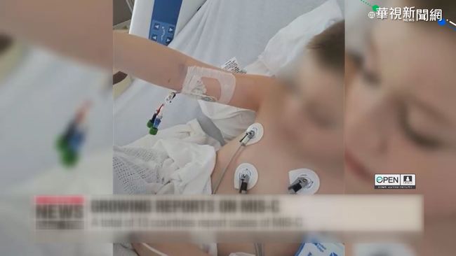 南韓爆「兒童怪病」 2童未染新冠病毒 | 華視新聞