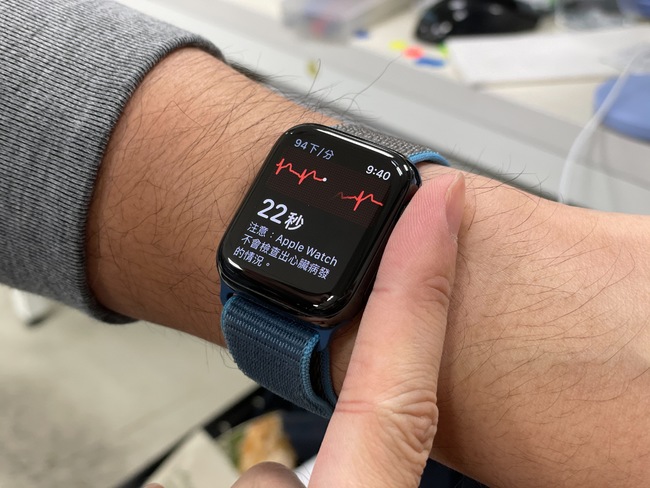 Apple Watch將開放「心電圖」 醫曝：不要有過高期待 | 華視新聞