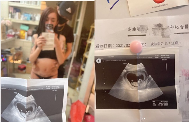 罔腰變性3年「宣布懷孕」 婦產名醫打臉：不要鬼扯 | 華視新聞