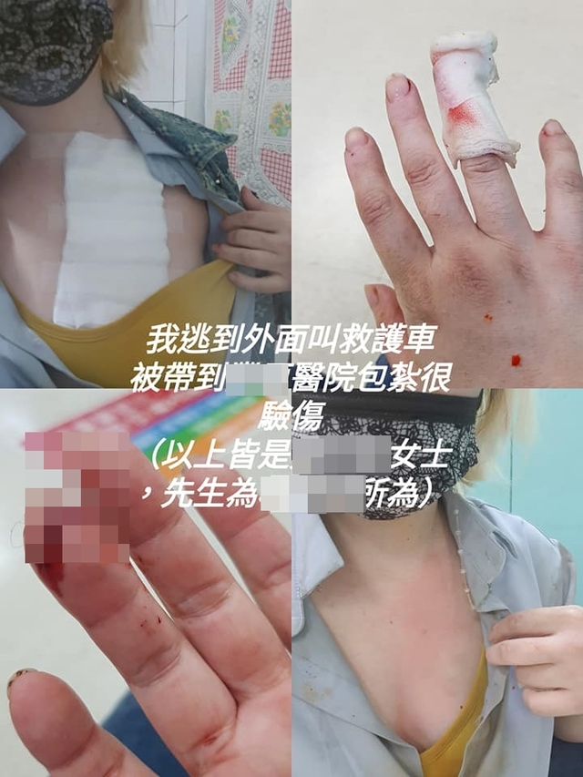 網友貼出自己受公婆傷害照片。（翻攝自臉書爆料公社二社）