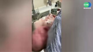男嬰屁股大片紅疹 母控月子中心照護疏失