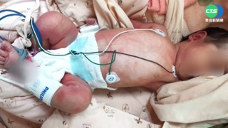 女嬰起紅疹險沒命 疑飲用水.奶瓶不潔害的