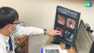 累壞了! 44歲女誤吞18cm牙刷急跑醫院