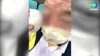 7旬翁遇行車糾紛遭毆 雙方互控傷害