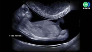 確診昏迷!28週胎兒保不住 20歲孕婦不治
