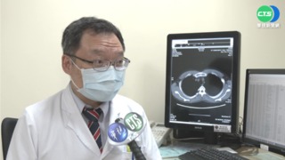 抗新冠"天選之人"?! 科學家推論三大類