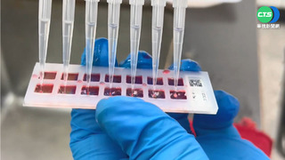 一滴血測疫苗保護力 成大研究登國際期刊