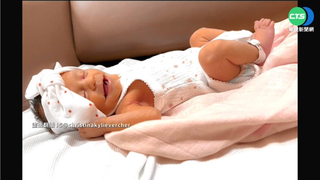 罹"巨口畸形症" 澳洲女嬰哭也"微笑" | 華視新聞