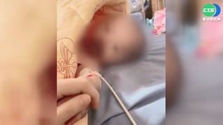 澎湖最小確診者 3個月女嬰高燒40度