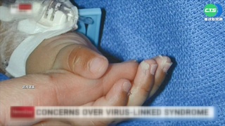 台首例"MIS-C" 10歲男童輕症癒後高燒休克