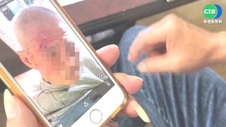 8旬翁摔倒受傷 安養中心認疏失.兒怒告