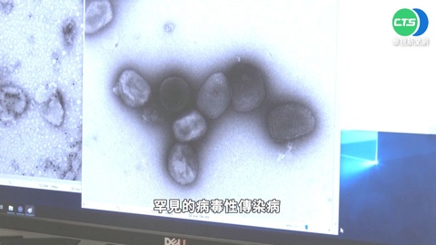 施打輝瑞疫苗引發猴痘? 專家:錯誤資訊