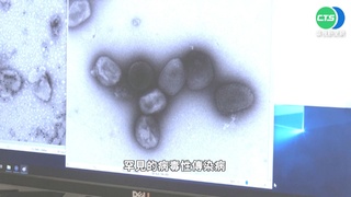 施打輝瑞疫苗引發猴痘? 專家:錯誤資訊