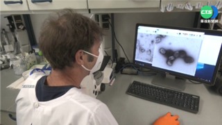 台首例"猴痘"境外移入 匡列9人監測到7/14