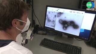 猴痘全世界超過3000例 醫:3危險族群注意