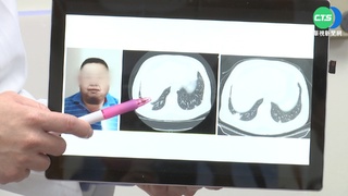 5寶爸罹癌買不起救命藥 仁醫向外界求助